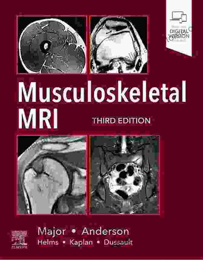 An Intricate Illustration From The Atlas Of Imaging Anatomy Depicting The Musculoskeletal System Atlas Of Imaging Anatomy Apurba S Sastry