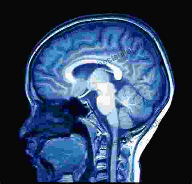 An MRI Scan Of A Human Brain, Showcasing The Intricate Connections And Structures. Psychiatry Made Easy: Overview Of Psychiatry