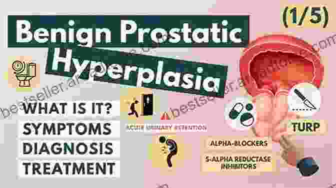 Benign Prostatic Hyperplasia Symptoms And Treatment How To Prevent Prostate Problems: A Complete Guide To The Essentials Of Prostate Health