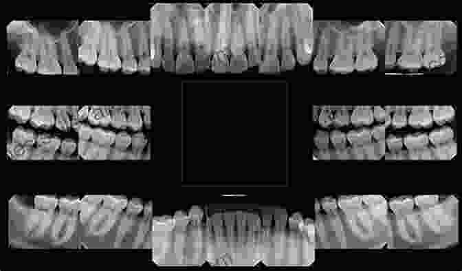 Dental Radiographs Showcasing Various Oral Pathologies Oral Radiology: Interpretation And Diagnostic Strategies An Issue Of Dental Clinics Of North America (The Clinics: Dentistry)