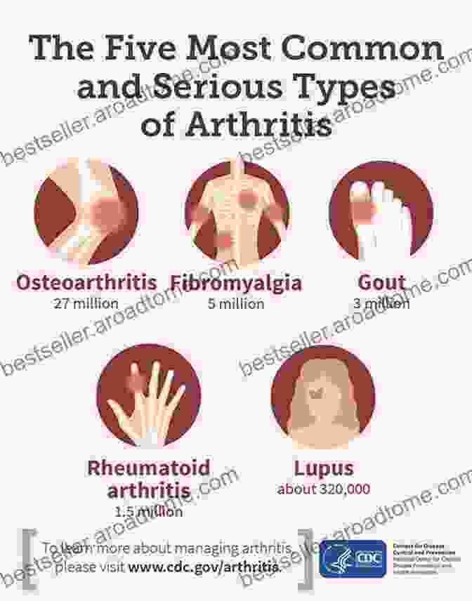 Diagram Showing Various Types Of Arthritis Natural Cure For Arthritis: Pain Free: Gaining Your Life Back