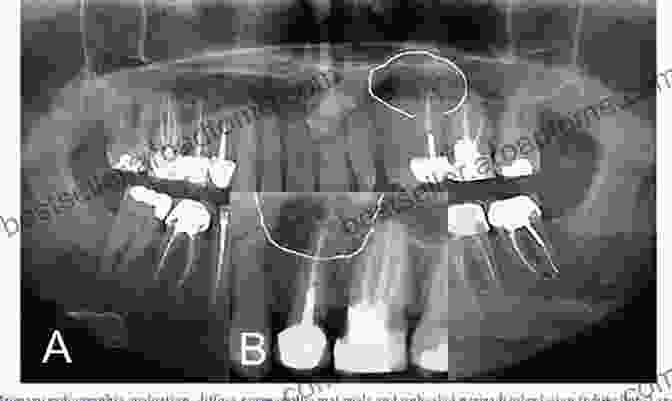 Endodontic Surgery For Managing Periradicular Disease Oral Radiology: Interpretation And Diagnostic Strategies An Issue Of Dental Clinics Of North America (The Clinics: Dentistry)