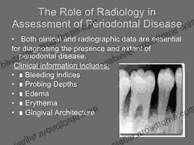 Periodontal Probing And Radiographic Assessment For Diagnosis Oral Radiology: Interpretation And Diagnostic Strategies An Issue Of Dental Clinics Of North America (The Clinics: Dentistry)