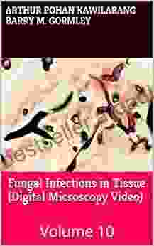 Fungal Infections in Tissue (Digital Microscopy Video): Volume 10